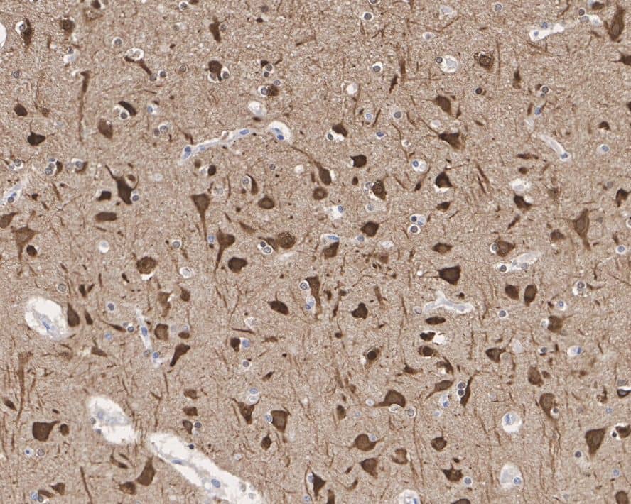 Immunohistochemistry: Tau [p Thr231] Antibody (PSH01-05) [NBP3-32810] - Immunohistochemical analysis of paraffin-embedded human brain tissue with Rabbit anti-Tau antibody (NBP3-32810) at 1/10,000 dilution. The section was pre-treated using heat mediated antigen retrieval with Tris-EDTA buffer (pH 9.0) for 20 minutes. The tissues were blocked in 1% BSA for 20 minutes at room temperature, washed with ddH2O and PBS, and then probed with the primary antibody (NBP3-32810) at 1/10,000 dilution for 1 hour at room temperature. The detection was performed using an HRP conjugated compact polymer system. DAB was used as the chromogen. Tissues were counterstained with hematoxylin and mounted with DPX.