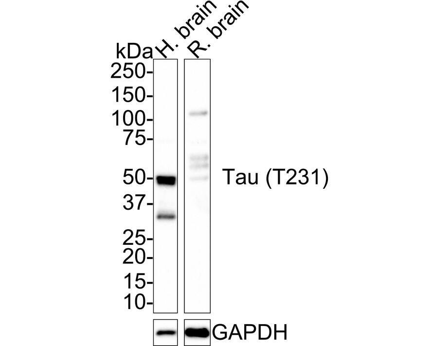 Western blot analysis on different lysates with NBP3-32811 at 1/1,000 dilution. Lane 1: Human brain tissue lysate Lane 2: Rat brain tissue lysate Lysates/proteins at 50 µg/Lane. Predicted band size: 46 kDa Observed band size: 35-100 kDa Exposure time: 5 minutes; 4-20% SDS-PAGE gel. Proteins were transferred to a PVDF membrane and blocked with 5% NFDM/TBST for 1 hour at room temperature. NBP3-32811 at 1/1,000 dilution was used in 5% NFDM/TBST at room temperature for 2 hours. Goat Anti-Rabbit IgG [HRP] Secondary Antibody at 1:100,000 dilution was used for 1 hour at room temperature.