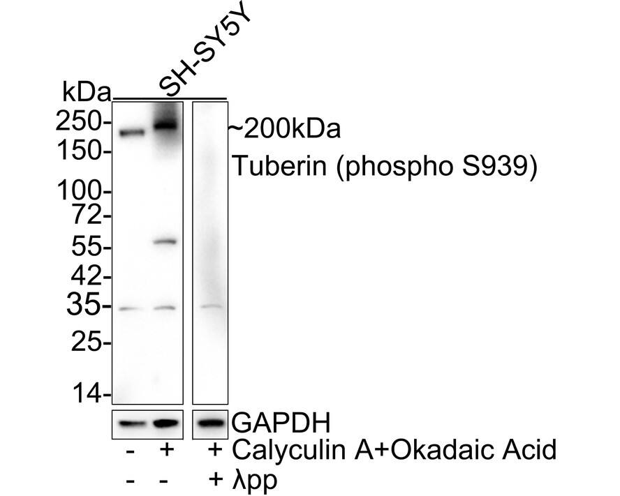 Western blot analysis on different lysates with NBP3-32812 at 1/1,000 dilution. Lane 1: SH-SY5Y cell lysate Lane 2: SH-SY5Y treated with 200nM Calyculin A and 1μM Okadaic Acid for 1 hour cell lysate Lane 3: SH-SY5Y treated with 200nM Calyculin A and 1μM Okadaic Acid for 1 hour, then treated with  lambda pp for 1 hour cell lysate Lysates/proteins at 20 µg/Lane. Predicted band size: 201 kDa Observed band size: 250 kDa Exposure time: 3 minutes; 4-20% SDS-PAGE gel. Proteins were transferred to a PVDF membrane and blocked with 5% NFDM/TBST for 1 hour at room temperature. NBP3-32812 at 1/1,000 dilution was used in 5% NFDM/TBST at 4℃ overnight. Goat Anti-Rabbit IgG [HRP] Secondary Antibody at 1/50,000 dilution was used for 1 hour at room temperature.