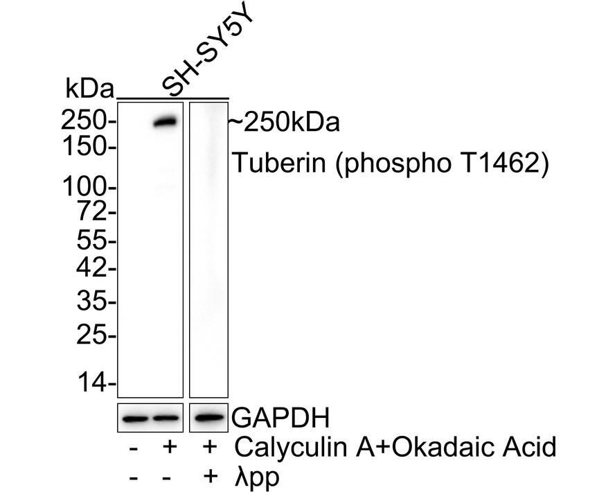 Western blot analysis on different lysates with NBP3-32813 at 1/1,000 dilution. Lane 1: SH-SY5Y cell lysate Lane 2: SH-SY5Y treated with 200nM Calyculin A and 1μM Okadaic Acid for 1 hour cell lysate Lane 3: SH-SY5Y treated with 200nM Calyculin A and 1μM Okadaic Acid for 1 hour, then treated with  lambda pp for 1 hour cell lysate Lysates/proteins at 20 µg/Lane. Predicted band size: 201 kDa Observed band size: 250 kDa Exposure time: 3 minutes; 4-20% SDS-PAGE gel. Proteins were transferred to a PVDF membrane and blocked with 5% NFDM/TBST for 1 hour at room temperature. NBP3-32813 at 1/1,000 dilution was used in 5% NFDM/TBST at 4℃ overnight. Goat Anti-Rabbit IgG [HRP] Secondary Antibody at 1/50,000 dilution was used for 1 hour at room temperature.