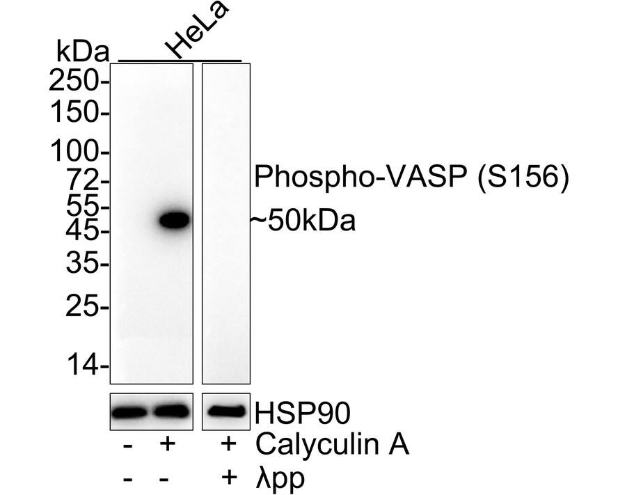 Western Blot: VASP [p Ser156] Antibody (JE45-91) [NBP3-32815] - Western blot analysis of VASP on different lysates with Rabbit anti-VASP antibody (NBP3-32815) at 1/1,000 dilution. Lane 1: HeLa cell lysate Lane 2: HeLa treated with 100ng/mL Calyculin A for 30 minutes cell lysate Lane 3: HeLa treated with 100ng/mL Calyculin A for 30 minutes cell lysate, then the membrane treated with  pp for 1 hour Lysates/proteins at 20 ug/Lane. Predicted band size: 40 kDa Observed band size: 50 kDa Exposure time: 3 minutes; ECL; 4-20% SDS-PAGE gel. Proteins were transferred to a PVDF membrane and blocked with 5% NFDM/TBST for 1 hour at room temperature. The primary antibody (NBP3-32815) at 1/1,000 dilution was used in 5% NFDM/TBST at 4C overnight. Goat Anti-Rabbit IgG - HRP Secondary Antibody at 1/50,000 dilution was used for 1 hour at room temperature.