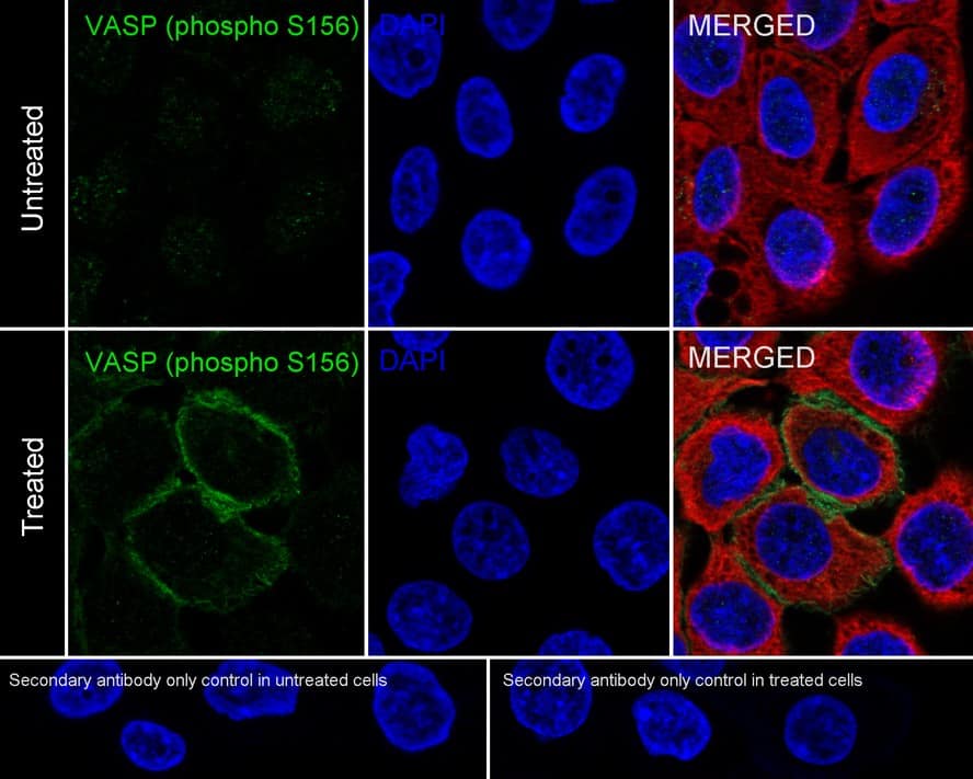 Immunocytochemistry/ Immunofluorescence: VASP [p Ser156] Antibody (JE45-91) [NBP3-32815] - Immunocytochemistry analysis of A431 cells treated with or without 10μM forskolin for 1 hour labeling VASP with Rabbit anti-VASP antibody (NBP3-32815) at 1/100 dilution. Cells were fixed in 4% paraformaldehyde for 20 minutes at room temperature, permeabilized with 0.1% Triton X-100 in PBS for 5 minutes at room temperature, then blocked with 1% BSA in 10% negative goat serum for 1 hour at room temperature. Cells were then incubated with Rabbit anti-VASP antibody (NBP3-32815) at 1/100 dilution in 1% BSA in PBST overnight at 4 ℃. Goat Anti-Rabbit IgG H&L (iFluor™ 488) was used as the secondary antibody at 1/1,000 dilution. PBS instead of the primary antibody was used as the secondary antibody only control. Nuclear DNA was labelled in blue with DAPI. Beta tubulin (red) was stained at 1/100 dilution overnight at +4℃. Goat Anti-Mouse IgG H&L (iFluor™ 594) was used as the secondary antibody at 1/1,000 dilution.