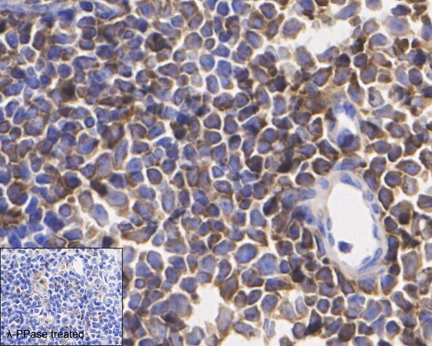 Immunohistochemistry: VASP [p Ser156] Antibody (JE45-91) [NBP3-32815] - Immunohistochemical analysis of paraffin-embedded mouse spleen tissue with Rabbit anti-VASP antibody (NBP3-32815) at 1/1,000 dilution. The section was pre-treated using heat mediated antigen retrieval with Tris-EDTA buffer (pH 9.0) for 20 minutes. The tissues were blocked in 1% BSA for 20 minutes at room temperature, washed with ddH2O and PBS, and then probed with the primary antibody (NBP3-32815) at 1/1,000 dilution for 1 hour at room temperature. The detection was performed using an HRP conjugated compact polymer system. DAB was used as the chromogen. Tissues were counterstained with hematoxylin and mounted with DPX.