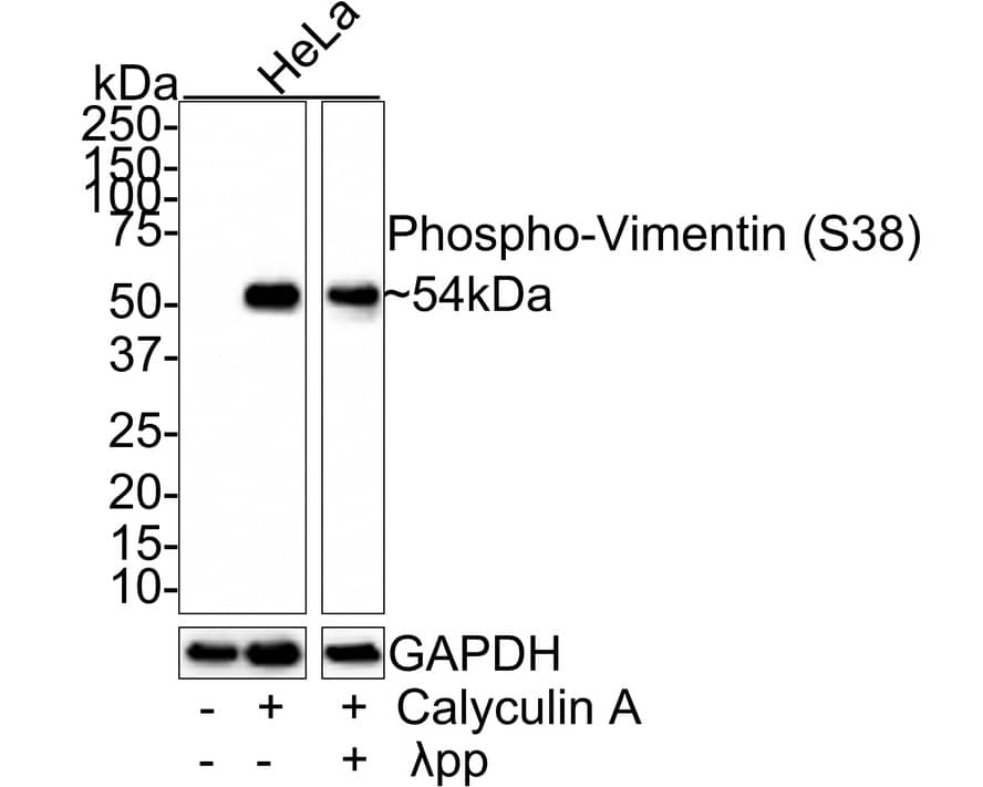 Western Blot: Vimentin [p Ser38] Antibody (JE43-26) [NBP3-32816] - Western blot analysis of Vimentin on different lysates with Rabbit anti-Vimentin antibody (NBP3-32816) at 1/1,000 dilution. Lane 1: HeLa whole cell lysate Lane 2: HeLa treated with 100nM Calyculin A for 30 minutes whole cell lysate Lane 3: HeLa treated with 100nM Calyculin A for 30 minutes whole cell lysate, then the membrane treated with  pp for 1 hour Lysates/proteins at 20 ug/Lane. Predicted band size: 54 kDa Observed band size: 54 kDa Exposure time: 10 seconds; 4-20% SDS-PAGE gel. Proteins were transferred to a PVDF membrane and blocked with 5% NFDM/TBST for 1 hour at room temperature. The primary antibody (NBP3-32816) at 1/1,000 dilution was used in 5% NFDM/TBST at room temperature for 2 hours. Goat Anti-Rabbit IgG - HRP Secondary Antibody at 1/100,000 dilution was used for 1 hour at room temperature.