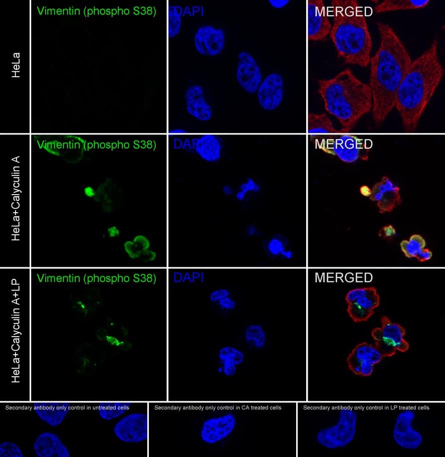 Immunocytochemistry/ Immunofluorescence: Vimentin [p Ser38] Antibody (JE43-26) [NBP3-32816] - Immunocytochemistry analysis of HeLa cells treated with or without 100nM Calyculin A for 30 minutes, then treated with  lambda pp for 1 hour labeling Vimentin with Rabbit anti-Vimentin antibody (NBP3-32816) at 1/100 dilution. Cells were fixed in 4% paraformaldehyde for 10 minutes at 37 ℃, permeabilized with 0.05% Triton X-100 in PBS for 20 minutes, and then blocked with 2% negative goat serum for 30 minutes at room temperature. Cells were then incubated with Rabbit anti-Vimentin antibody (NBP3-32816) at 1/100 dilution in 2% negative goat serum overnight at 4 ℃. Goat Anti-Rabbit IgG H&L (iFluor™ 488) was used as the secondary antibody at 1/1,000 dilution. Nuclear DNA was labelled in blue with DAPI. Beta tubulin (red) was stained at 1/100 dilution overnight at +4℃. Goat Anti-Mouse IgG H&L (iFluor™ 594) was used as the secondary antibody at 1/1,000 dilution.