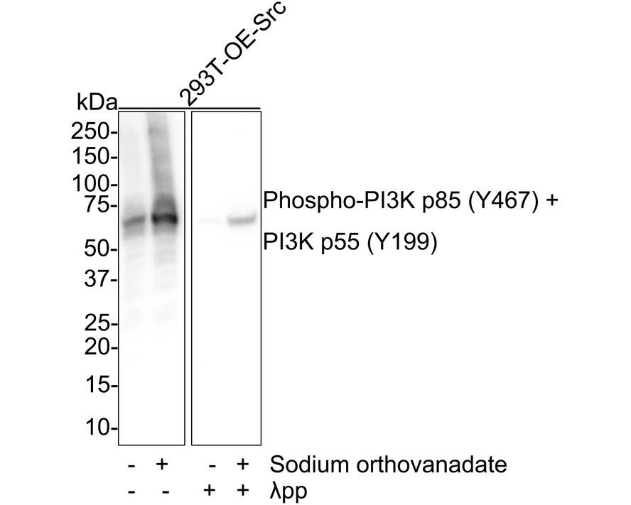 Western blot analysis on different lysates with NBP3-32818 at 1/1,000 dilution. Lane 1: 293T overexpress Src cell lysate Lane 2: 293T overexpress Src treated with 1mM sodium orthovanadate for 30 minutes cell lysate Lane 3: 293T overexpress Src cell lysate, the membrane treated with  lambda pp for 1 hour Lane 4: 293T overexpress Src treated with 1mM sodium orthovanadate for 30 minutes cell lysate, then the membrane treated with  lambda pp for 1 hour Lysates/proteins at 20 µg/Lane. Predicted band size: 84 kDa Observed band size: 55 kDa Exposure time: 28 seconds;  4-20% SDS-PAGE gel. Proteins were transferred to a PVDF membrane and blocked with 5% NFDM/TBST for 1 hour at room temperature. NBP3-32818 at 1/1,000 dilution was used in 5% NFDM/TBST at room temperature for 2 hours. Goat Anti-Rabbit IgG [HRP] Secondary Antibody at 1/100,000 dilution was used for 1 hour at room temperature.