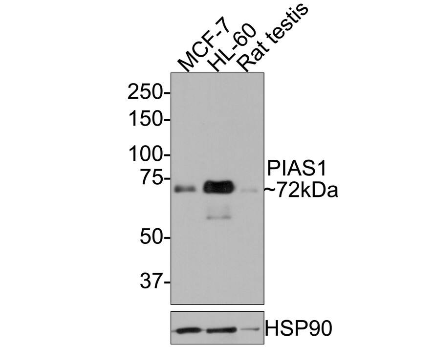 Western blot analysis on different lysates with NBP3-32820 at 1/500 dilution. Lane 1: MCF-7 cell lysate Lane 2: HL-60 cell lysate Lane 3: Rat testis tissue lysate (20 µg/Lane) Lysates/proteins at 10 µg/Lane. Predicted band size: 68 kDa Observed band size: 72 kDa Exposure time: 2 minutes; 8% SDS-PAGE gel. Proteins were transferred to a PVDF membrane and blocked with 5% NFDM/TBST for 1 hour at room temperature. NBP3-32820 at 1/500 dilution was used in 5% NFDM/TBST at room temperature for 2 hours. Goat Anti-Rabbit IgG [HRP] Secondary Antibody at 1:300,000 dilution was used for 1 hour at room temperature.