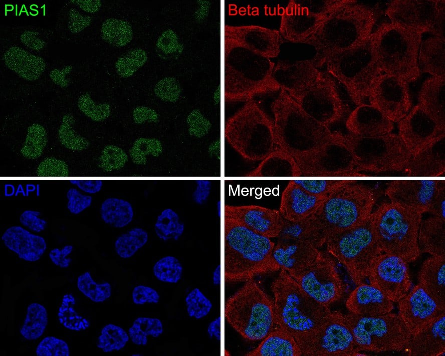 Immunocytochemistry/ Immunofluorescence: PIAS3 Antibody (JE30-36) [NBP3-32820] - Immunocytochemistry analysis of NCI-H441 cells labeling PIAS3 with Rabbit anti-PIAS3 antibody (NBP3-32820) at 1/50 dilution. Cells were fixed in 4% paraformaldehyde for 10 minutes at 37 ℃, permeabilized with 0.05% Triton X-100 in PBS for 20 minutes, and then blocked with 2% negative goat serum for 30 minutes at room temperature. Cells were then incubated with Rabbit anti-PIAS3 antibody (NBP3-32820) at 1/50 dilution in 2% negative goat serum overnight at 4 ℃. Goat Anti-Rabbit IgG H&L (Alexa Fluor® 488) was used as the secondary antibody at 1/1,000 dilution. Nuclear DNA was labelled in blue with DAPI. Beta tubulin (red) was stained at 1/200 dilution overnight at +4℃. Goat Anti-Mouse IgG H&L (iFluor™ 647) were used as the secondary antibody at 1/1,000 dilution.