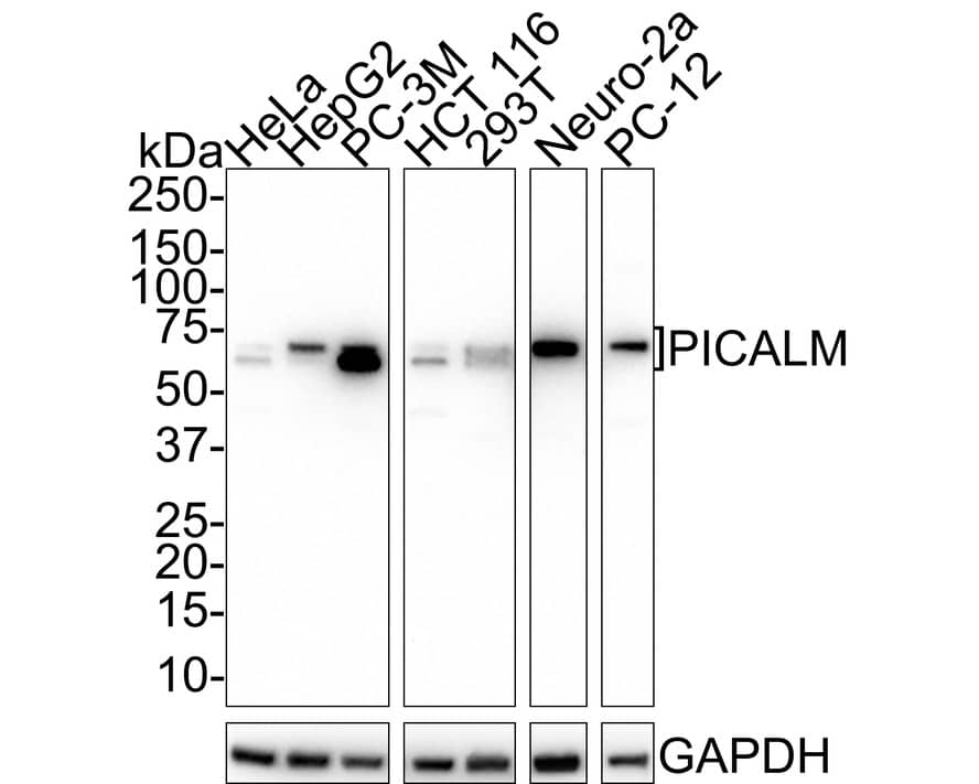 Western Blot: PICALM Antibody (PSH01-64) [NBP3-32822] - Western blot analysis of PICALM on different lysates with Rabbit anti-PICALM antibody (NBP3-32822) at 1/1,000 dilution. Lane 1: HeLa cell lysate Lane 2: HepG2 cell lysate Lane 3: PC-3M cell lysate Lane 4: HCT 116 cell lysate Lane 5: 293T cell lysate Lane 6: Neuro-2a cell lysate Lane 7: PC-12 cell lysate Lysates/proteins at 20 ug/Lane. Predicted band size: 71 kDa Observed band size: 65/71 kDa Exposure time: 3 minutes; 4-20% SDS-PAGE gel. Proteins were transferred to a PVDF membrane and blocked with 5% NFDM/TBST for 1 hour at room temperature. The primary antibody (NBP3-32822) at 1/1,000 dilution was used in 5% NFDM/TBST at room temperature for 2 hours. Goat Anti-Rabbit IgG - HRP Secondary Antibody at 1/50,000 dilution was used for 1 hour at room temperature.