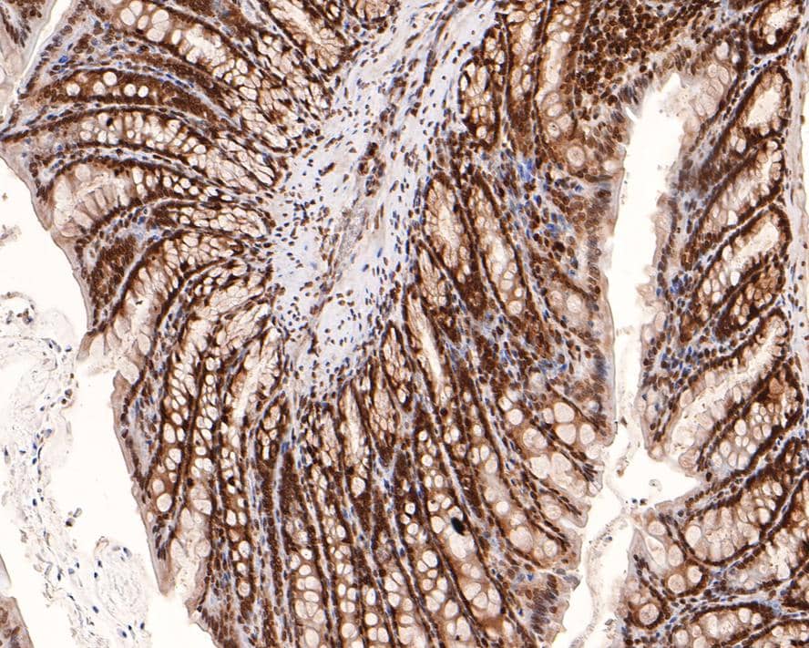 Immunohistochemistry: PIN4 Antibody (JE64-05) [NBP3-32823] - Immunohistochemical analysis of paraffin-embedded rat large intestine tissue with Rabbit anti-PIN4 antibody (NBP3-32823) at 1/2,000 dilution. The section was pre-treated using heat mediated antigen retrieval with sodium citrate buffer (pH 6.0) for 2 minutes. The tissues were blocked in 1% BSA for 20 minutes at room temperature, washed with ddH2O and PBS, and then probed with the primary antibody (NBP3-32823) at 1/2,000 dilution for 1 hour at room temperature. The detection was performed using an HRP conjugated compact polymer system. DAB was used as the chromogen. Tissues were counterstained with hematoxylin and mounted with DPX.