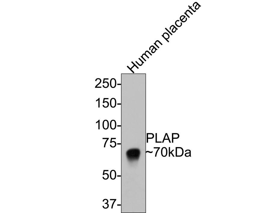 Western Blot: Alkaline Phosphatase/ALPP Antibody (PD00-19) [NBP3-32826] - Western blot analysis of Alkaline Phosphatase/ALPP on human placenta tissue lysates with Rabbit anti-Alkaline Phosphatase/ALPP antibody (NBP3-32826) at 1/500 dilution. Lysates/proteins at 20 ug/Lane. Predicted band size: 58 kDa Observed band size: 70 kDa Exposure time: 30 seconds; 8% SDS-PAGE gel. Proteins were transferred to a PVDF membrane and blocked with 5% NFDM/TBST for 1 hour at room temperature. The primary antibody (NBP3-32826) at 1/500 dilution was used in 5% NFDM/TBST at room temperature for 2 hours. Goat Anti-Rabbit IgG - HRP Secondary Antibody at 1:300,000 dilution was used for 1 hour at room temperature.