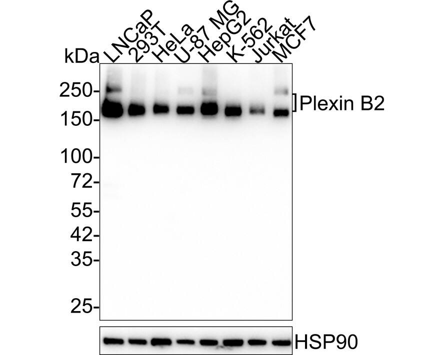 Western Blot: Plexin B2 Antibody (PSH03-48) [NBP3-32828] - Western blot analysis of Plexin B2 on different lysates with Rabbit anti-Plexin B2 antibody (NBP3-32828) at 1/2,000 dilution. Lane 1: LNCaP cell lysate Lane 2: 293T cell lysate Lane 3: HeLa cell lysate Lane 4: U-87 MG cell lysate Lane 5: HepG2 cell lysate Lane 6: K-562 cell lysate Lane 7: Jurkat cell lysate Lane 8: MCF7 cell lysate Lysates/proteins at 20 ug/Lane. Predicted band size: 205 kDa Observed band size: 170/240 kDa Exposure time: 43 seconds; 4-20% SDS-PAGE gel. Proteins were transferred to a PVDF membrane and blocked with 5% NFDM/TBST for 1 hour at room temperature. The primary antibody (NBP3-32828) at 1/2,000 dilution was used in 5% NFDM/TBST at 4C overnight. Goat Anti-Rabbit IgG - HRP Secondary Antibody at 1/50,000 dilution was used for 1 hour at room temperature.