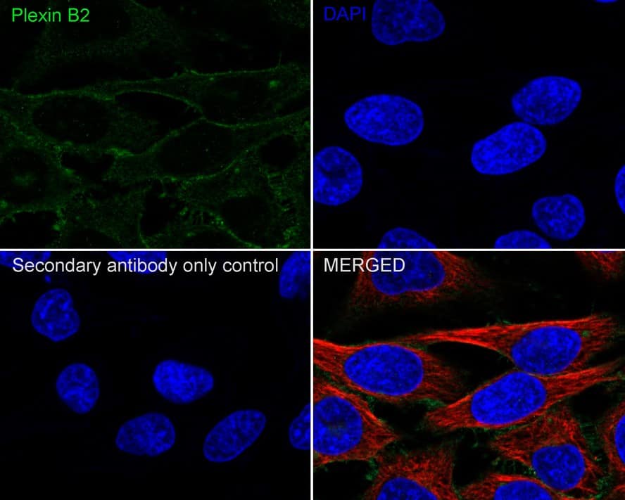 Immunocytochemistry/ Immunofluorescence: Plexin B2 Antibody (PSH03-48) [NBP3-32828] - Immunocytochemistry analysis of HeLa cells labeling Plexin B2 with Rabbit anti-Plexin B2 antibody (NBP3-32828) at 1/100 dilution. Cells were fixed in 100% precooled methanol for 5 minutes at room temperature, then blocked with 1% BSA in 10% negative goat serum for 1 hour at room temperature. Cells were then incubated with Rabbit anti-Plexin B2 antibody (NBP3-32828) at 1/100 dilution in 1% BSA in PBST overnight at 4 ℃. Goat Anti-Rabbit IgG H&L (iFluor™ 488) was used as the secondary antibody at 1/1,000 dilution. PBS instead of the primary antibody was used as the secondary antibody only control. Nuclear DNA was labelled in blue with DAPI. Beta tubulin (red) was stained at 1/100 dilution overnight at +4℃. Goat Anti-Mouse IgG H&L (iFluor™ 594) was used as the secondary antibody at 1/1,000 dilution.