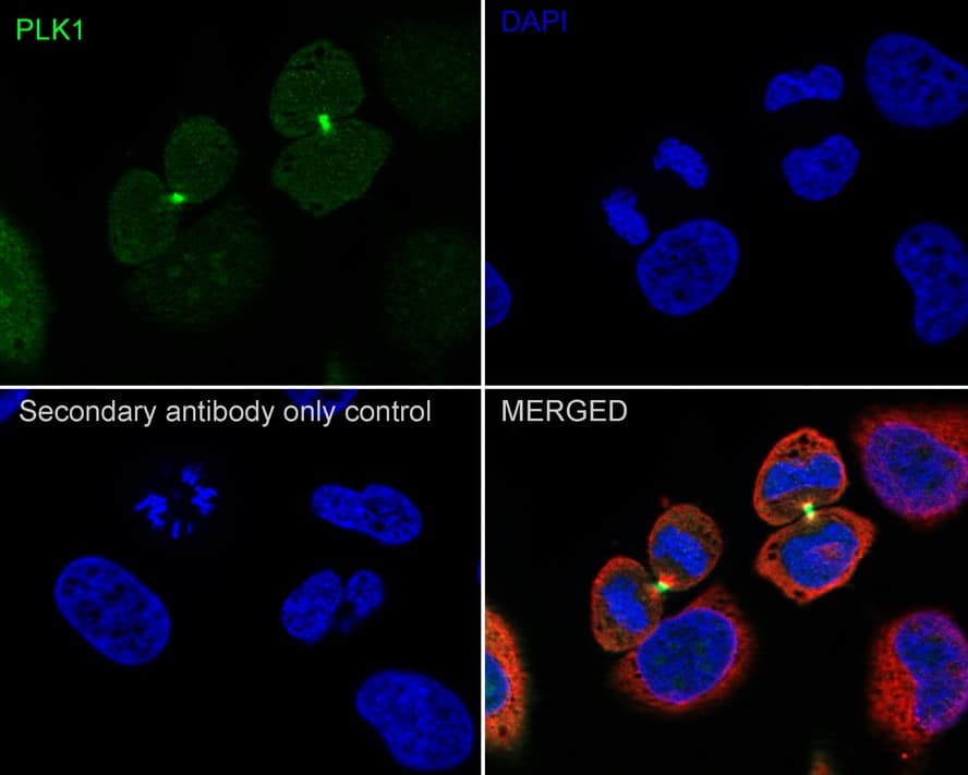 Immunocytochemistry/ Immunofluorescence: PLK1 Antibody (PSH04-35) [NBP3-32829] - Immunocytochemistry analysis of HeLa cells labeling PLK1 with Rabbit anti-PLK1 antibody (NBP3-32829) at 1/100 dilution. Cells were fixed in 4% paraformaldehyde for 20 minutes at room temperature, permeabilized with 0.1% Triton X-100 in PBS for 5 minutes at room temperature, then blocked with 1% BSA in 10% negative goat serum for 1 hour at room temperature. Cells were then incubated with Rabbit anti-PLK1 antibody (NBP3-32829) at 1/100 dilution in 1% BSA in PBST overnight at 4 ℃. Goat Anti-Rabbit IgG H&L (iFluor™ 488) was used as the secondary antibody at 1/1,000 dilution. PBS instead of the primary antibody was used as the secondary antibody only control. Nuclear DNA was labelled in blue with DAPI. Beta tubulin (red) was stained at 1/100 dilution overnight at +4℃. Goat Anti-Mouse IgG H&L (iFluor™ 594) was used as the secondary antibody at 1/1,000 dilution.