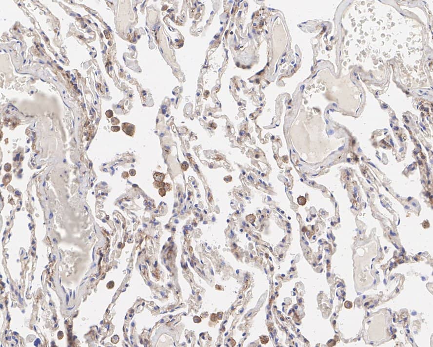 Immunohistochemistry: PMCA1 Antibody (JE34-05) [NBP3-32830] - Immunohistochemical analysis of paraffin-embedded human lung tissue with Rabbit anti-PMCA1 antibody (NBP3-32830) at 1/200 dilution. The section was pre-treated using heat mediated antigen retrieval with Tris-EDTA buffer (pH 9.0) for 20 minutes. The tissues were blocked in 1% BSA for 20 minutes at room temperature, washed with ddH2O and PBS, and then probed with the primary antibody (NBP3-32830) at 1/200 dilution for 1 hour at room temperature. The detection was performed using an HRP conjugated compact polymer system. DAB was used as the chromogen. Tissues were counterstained with hematoxylin and mounted with DPX.