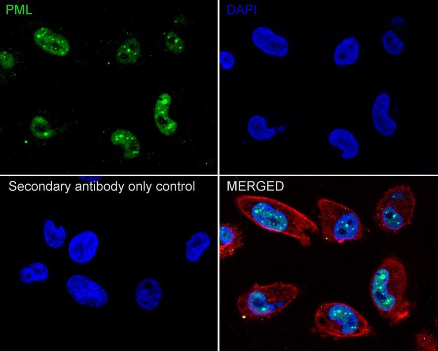 Immunocytochemistry/ Immunofluorescence: PML Protein Antibody (PSH02-68) [NBP3-32831] - Immunocytochemistry analysis of MDA-MB-231 cells labeling PML Protein with Rabbit anti-PML Protein antibody (NBP3-32831) at 1/100 dilution. Cells were fixed in 4% paraformaldehyde for 20 minutes at room temperature, permeabilized with 0.1% Triton X-100 in PBS for 5 minutes at room temperature, then blocked with 1% BSA in 10% negative goat serum for 1 hour at room temperature. Cells were then incubated with Rabbit anti-PML Protein antibody (NBP3-32831) at 1/100 dilution in 1% BSA in PBST overnight at 4 ℃. Goat Anti-Rabbit IgG H&L (iFluor™ 488) was used as the secondary antibody at 1/1,000 dilution. PBS instead of the primary antibody was used as the secondary antibody only control. Nuclear DNA was labelled in blue with DAPI. Beta tubulin (red) was stained at 1/100 dilution overnight at +4℃. Goat Anti-Mouse IgG H&L (iFluor™ 594) was used as the secondary antibody at 1/1,000 dilution.