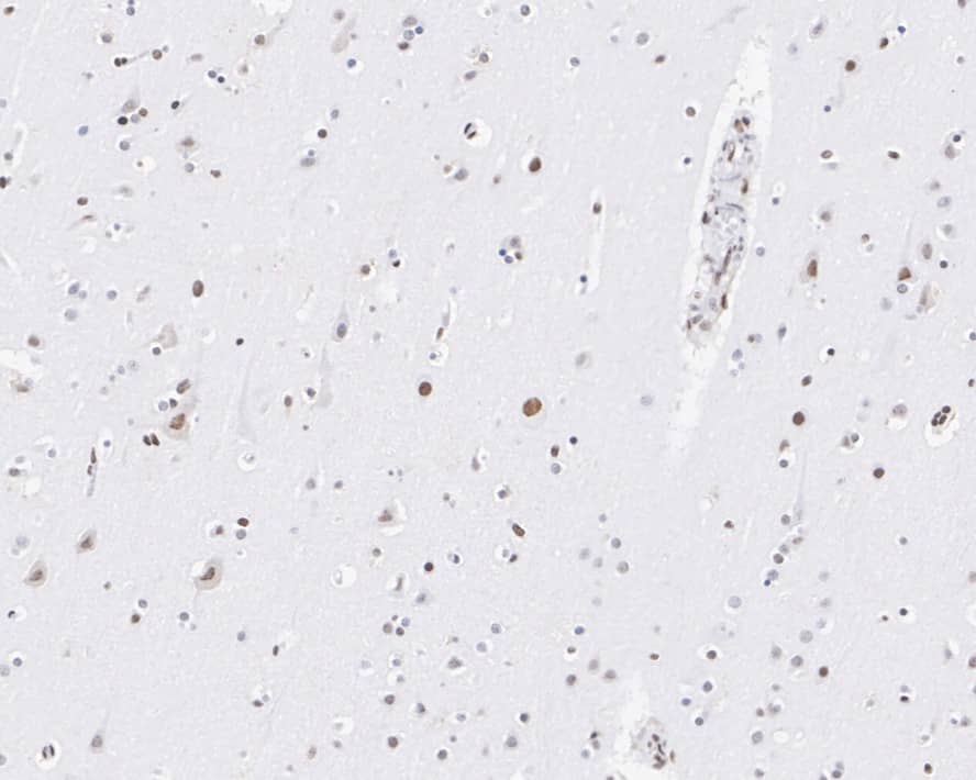 Immunohistochemistry: PML Protein Antibody (PSH02-68) [NBP3-32831] - Immunohistochemical analysis of paraffin-embedded human brain tissue with Rabbit anti-PML Protein antibody (NBP3-32831) at 1/1,000 dilution. The section was pre-treated using heat mediated antigen retrieval with sodium citrate buffer (pH 6.0) for 2 minutes. The tissues were blocked in 1% BSA for 20 minutes at room temperature, washed with ddH2O and PBS, and then probed with the primary antibody (NBP3-32831) at 1/1,000 dilution for 1 hour at room temperature. The detection was performed using an HRP conjugated compact polymer system. DAB was used as the chromogen. Tissues were counterstained with hematoxylin and mounted with DPX.