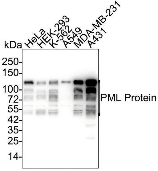 Western Blot PML Protein Antibody (PSH02-89)