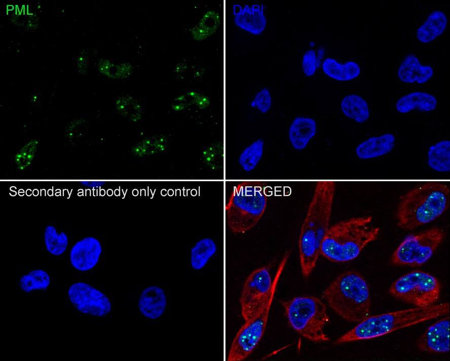 Immunocytochemistry/ Immunofluorescence: PML Protein Antibody (PSH02-89) [NBP3-32832] - Immunocytochemistry analysis of MDA-MB-231 cells labeling PML Protein with Rabbit anti-PML Protein antibody (NBP3-32832) at 1/100 dilution. Cells were fixed in 4% paraformaldehyde for 20 minutes at room temperature, permeabilized with 0.1% Triton X-100 in PBS for 5 minutes at room temperature, then blocked with 1% BSA in 10% negative goat serum for 1 hour at room temperature. Cells were then incubated with Rabbit anti-PML Protein antibody (NBP3-32832) at 1/100 dilution in 1% BSA in PBST overnight at 4 ℃. Goat Anti-Rabbit IgG H&L (iFluor™ 488) was used as the secondary antibody at 1/1,000 dilution. PBS instead of the primary antibody was used as the secondary antibody only control. Nuclear DNA was labelled in blue with DAPI. Beta tubulin (red) was stained at 1/100 dilution overnight at +4℃. Goat Anti-Mouse IgG H&L (iFluor™ 594) was used as the secondary antibody at 1/1,000 dilution.