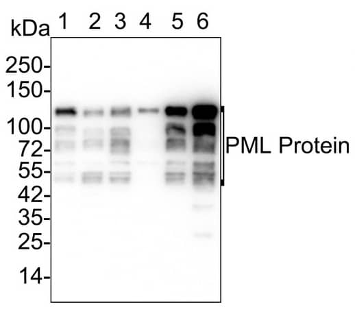 Western Blot: PML Protein Antibody (PSH02-89) [NBP3-32832] - Western blot analysis of PML Protein on different lysates with Rabbit anti-PML Protein antibody (NBP3-32832) at 1/2,000 dilution. Lane 1: HeLa cell lysate (15 µg/Lane) Lane 2: HEK-293 cell lysate (15 µg/Lane) Lane 3: K-562 cell lysate (15 µg/Lane) Lane 4: A549 cell lysate (15 µg/Lane) Lane 5: MDA-MB-231 cell lysate (15 µg/Lane) Lane 6: A431 cell lysate (15 µg/Lane) Predicted band size: 98 kDa Observed band size: 50-130 kDa Exposure time: 1 minute 59 seconds; 4-20% SDS-PAGE gel. Proteins were transferred to a PVDF membrane and blocked with 5% NFDM/TBST for 1 hour at room temperature. The primary antibody at 1/2,000 dilution was used in 5% NFDM/TBST at 4℃ overnight. Goat Anti-Rabbit IgG - HRP Secondary Antibody at 1/50,000 dilution was used for 1 hour at room temperature.