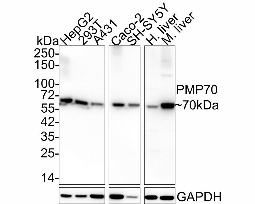 Western blot analysis on different lysates with NBP3-32834 at 1/2,000 dilution. Lane 1: HepG2 cell lysate (20 µg/Lane) Lane 2: 293T cell lysate (20 µg/Lane) Lane 3: A431 cell lysate (20 µg/Lane) Lane 4: Caco-2 cell lysate (20 µg/Lane) Lane 5: SH-SY5Y cell lysate (20 µg/Lane) Lane 6: Human liver tissue lysate (40 µg/Lane) Lane 7: Mouse liver tissue lysate (40 µg/Lane) Lysates/proteins at 10 µg/Lane. Predicted band size: 76 kDa Observed band size: 70 kDa Exposure time: 24 seconds; 4-20% SDS-PAGE gel. Proteins were transferred to a PVDF membrane and blocked with 5% NFDM/TBST for 1 hour at room temperature. NBP3-32834 at 1/2,000 dilution was used in 5% NFDM/TBST at 4℃ overnight. Goat Anti-Rabbit IgG [HRP] Secondary Antibody at 1/50,000 dilution was used for 1 hour at room temperature.