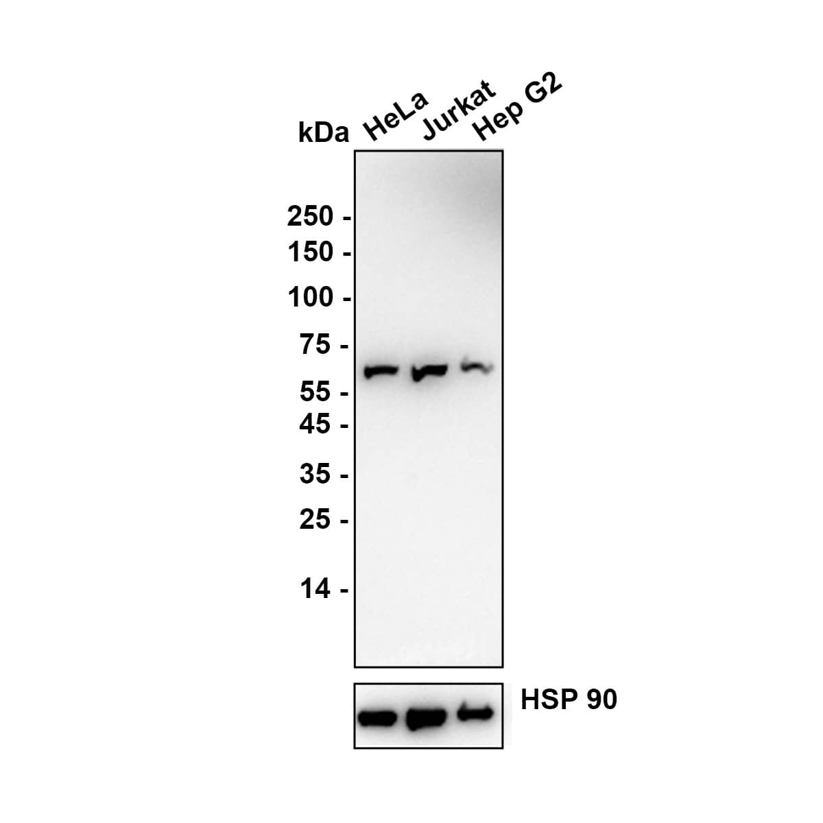 Western Blot PNK Antibody (JE64-21)