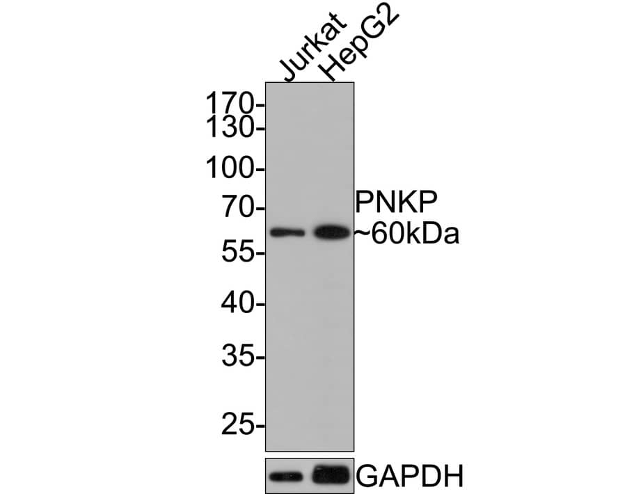 Western Blot: PNK Antibody (JE64-21) [NBP3-32835] - Western blot analysis of PNK on different lysates with Rabbit anti-PNK antibody (NBP3-32835) at 1/1,000 dilution. Lane 1: Jurkat cell lysate Lane 2: HepG2 cell lysate Lysates/proteins at 10 ug/Lane. Predicted band size: 57 kDa Observed band size: 60 kDa Exposure time: 2 minutes; 10% SDS-PAGE gel. Proteins were transferred to a PVDF membrane and blocked with 5% NFDM/TBST for 1 hour at room temperature. The primary antibody (NBP3-32835) at 1/1,000 dilution was used in 5% NFDM/TBST at room temperature for 2 hours. Goat Anti-Rabbit IgG - HRP Secondary Antibody at 1:300,000 dilution was used for 1 hour at room temperature.