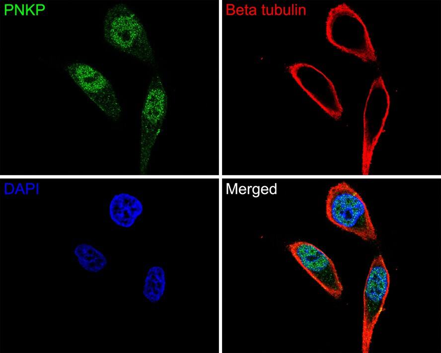 Immunocytochemistry/ Immunofluorescence: PNK Antibody (JE64-21) [NBP3-32835] - Immunocytochemistry analysis of Hela cells labeling PNK with Rabbit anti-PNK antibody (NBP3-32835) at 1/100 dilution. Cells were fixed in 4% paraformaldehyde for 10 minutes at 37 ℃, permeabilized with 0.05% Triton X-100 in PBS for 20 minutes, and then blocked with 2% negative goat serum for 30 minutes at room temperature. Cells were then incubated with Rabbit anti-PNK antibody (NBP3-32835) at 1/100 dilution in 2% negative goat serum overnight at 4 ℃. Goat Anti-Rabbit IgG H&L (Alexa Fluor® 488) was used as the secondary antibody at 1/1,000 dilution. Nuclear DNA was labelled in blue with DAPI. Beta tubulin (red) was stained at 1/200 dilution overnight at +4℃. Goat Anti-Mouse IgG H&L (Alexa Fluor® 555) were used as the secondary antibody at 1/1,000 dilution.