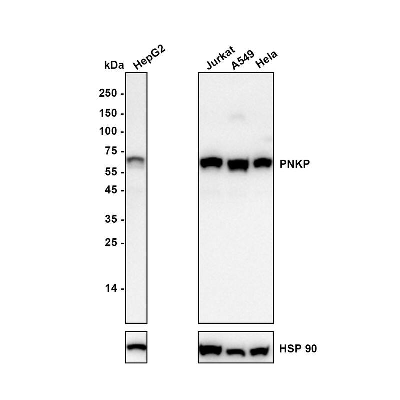 Western blot analysis on different lysates with NBP3-32836 at 1/5,000 dilution. Lane 1: HepG2 (Human liver cancer cell) cell lysate Lane 2: Jurkat (Human T-lymphoblastic cells) cell lysate Lane 3: A549 (Human lung adenocarcinoma cell) cell lysate Lane4: Hela (Human cervical adenocarcinoma cell) cell lysate Lysates/proteins at 20 µg/Lane. Exposure time: 3 minutes Blocking: 5% NFDM/TBST, 1 hour at room temperature Primary antibody: NBP3-32836, 1/5,000 in primary antibody dilution buffer, overnight at 4 ℃ Secondary antibody: Goat Anti-Rabbit IgG [HRP] Secondary Antibody, 1/50,000 in 5% NFDM/TBST, 1 hour at room temperature Predicted band size: 57.1 kDa Observed band size: 60 kDa