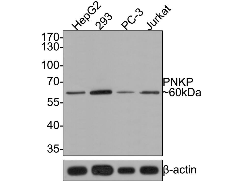 Western Blot: PNK Antibody (JE64-85) [NBP3-32836] - Western blot analysis of PNK on different lysates with Rabbit anti-PNK antibody (NBP3-32836) at 1/500 dilution. Lane 1: HepG2 cell lysate Lane 2: 293 cell lysate Lane 3: PC-3 cell lysate Lane 4: Jurkat cell lysate Lysates/proteins at 10 ug/Lane. Predicted band size: 57 kDa Observed band size: 60 kDa Exposure time: 2 minutes; 10% SDS-PAGE gel. Proteins were transferred to a PVDF membrane and blocked with 5% NFDM/TBST for 1 hour at room temperature. The primary antibody (NBP3-32836) at 1/500 dilution was used in 5% NFDM/TBST at room temperature for 2 hours. Goat Anti-Rabbit IgG - HRP Secondary Antibody at 1:300,000 dilution was used for 1 hour at room temperature.