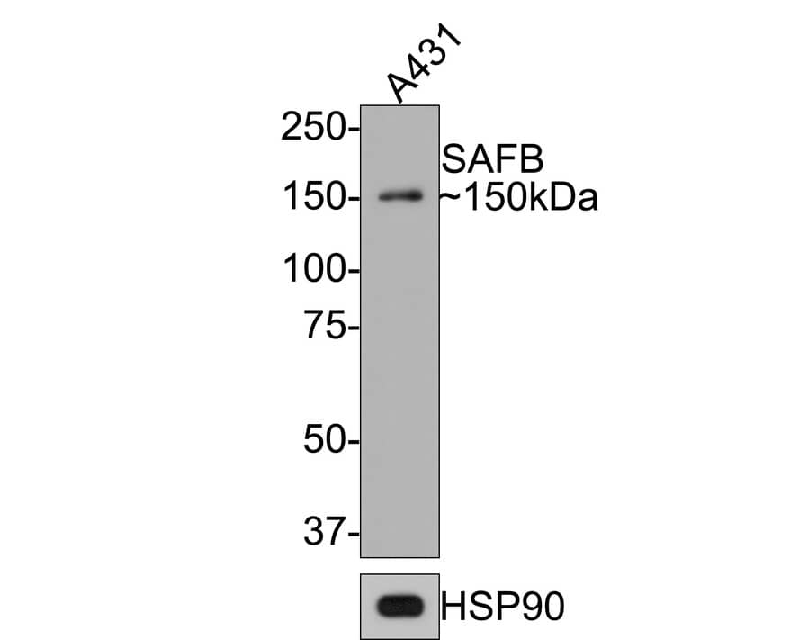 Western Blot: SAFB Antibody (JE64-94) [NBP3-32837] - Western blot analysis of SAFB on A431 cell lysates with Rabbit anti-SAFB antibody (NBP3-32837) at 1/500 dilution. Lysates/proteins at 10 ug/Lane. Predicted band size: 103 kDa Observed band size: 150 kDa Exposure time: 2 minutes; 8% SDS-PAGE gel. Proteins were transferred to a PVDF membrane and blocked with 5% NFDM/TBST for 1 hour at room temperature. The primary antibody (NBP3-32837) at 1/500 dilution was used in 5% NFDM/TBST at room temperature for 2 hours. Goat Anti-Rabbit IgG - HRP Secondary Antibody at 1:300,000 dilution was used for 1 hour at room temperature.