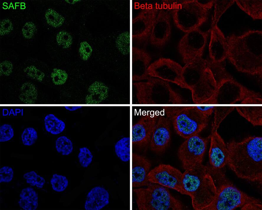 Immunocytochemistry/ Immunofluorescence: SAFB Antibody (JE64-94) [NBP3-32837] - Immunocytochemistry analysis of NCI-H441 cells labeling SAFB with Rabbit anti-SAFB antibody (NBP3-32837) at 1/50 dilution. Cells were fixed in 4% paraformaldehyde for 10 minutes at 37 ℃, permeabilized with 0.05% Triton X-100 in PBS for 20 minutes, and then blocked with 2% negative goat serum for 30 minutes at room temperature. Cells were then incubated with Rabbit anti-SAFB antibody (NBP3-32837) at 1/50 dilution in 2% negative goat serum overnight at 4 ℃. Goat Anti-Rabbit IgG H&L (Alexa Fluor® 488) was used as the secondary antibody at 1/1,000 dilution. Nuclear DNA was labelled in blue with DAPI. Beta tubulin (red) was stained at 1/200 dilution overnight at +4℃. Goat Anti-Mouse IgG H&L (iFluor™ 647) were used as the secondary antibody at 1/1,000 dilution.