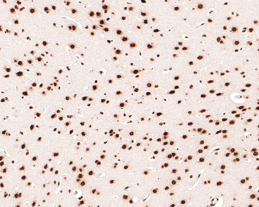 Immunohistochemistry: SAFB Antibody (JE64-94) [NBP3-32837] - Immunohistochemical analysis of paraffin-embedded rat brain tissue with Rabbit anti-SAFB antibody (NBP3-32837) at 1/400 dilution. The section was pre-treated using heat mediated antigen retrieval with sodium citrate buffer (pH 6.0) for 2 minutes. The tissues were blocked in 1% BSA for 20 minutes at room temperature, washed with ddH2O and PBS, and then probed with the primary antibody (NBP3-32837) at 1/400 dilution for 1 hour at room temperature. The detection was performed using an HRP conjugated compact polymer system. DAB was used as the chromogen. Tissues were counterstained with hematoxylin and mounted with DPX.