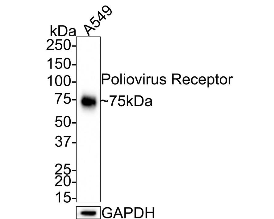 Western blot analysis of  A549 cell lysates with NBP3-32840 at 1/1,000 dilution. Lysates/proteins at 20 µg/Lane. Predicted band size: 45 kDa Observed band size: 75 kDa Exposure time: 25 seconds; 4-20% SDS-PAGE gel. Proteins were transferred to a PVDF membrane and blocked with 5% NFDM/TBST for 1 hour at room temperature. NBP3-32840 at 1/1,000 dilution was used in 5% NFDM/TBST at room temperature for 2 hours. Goat Anti-Rabbit IgG [HRP] Secondary Antibody at 1:100,000 dilution was used for 1 hour at room temperature.