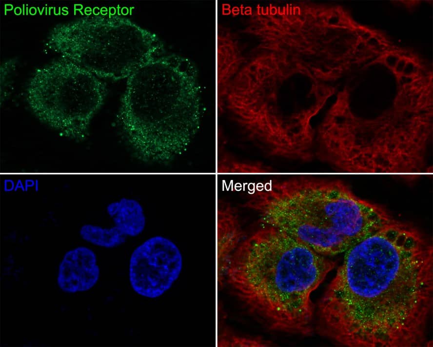 Immunocytochemistry/ Immunofluorescence: CD155/PVR Antibody (JE45-53) [NBP3-32840] - Immunocytochemistry analysis of HUVEC cells labeling CD155/PVR with Rabbit anti-CD155/PVR antibody (NBP3-32840) at 1/100 dilution. Cells were fixed in 4% paraformaldehyde for 10 minutes at 37 ℃, permeabilized with 0.05% Triton X-100 in PBS for 20 minutes, and then blocked with 2% negative goat serum for 30 minutes at room temperature. Cells were then incubated with Rabbit anti-CD155/PVR antibody (NBP3-32840) at 1/100 dilution in 2% negative goat serum overnight at 4 ℃. Goat Anti-Rabbit IgG H&L (iFluor™ 488) was used as the secondary antibody at 1/1,000 dilution. Nuclear DNA was labelled in blue with DAPI. Beta tubulin (red) was stained at 1/100 dilution overnight at +4℃. Goat Anti-Mouse IgG H&L (iFluor™ 594) was used as the secondary antibody at 1/1,000 dilution.