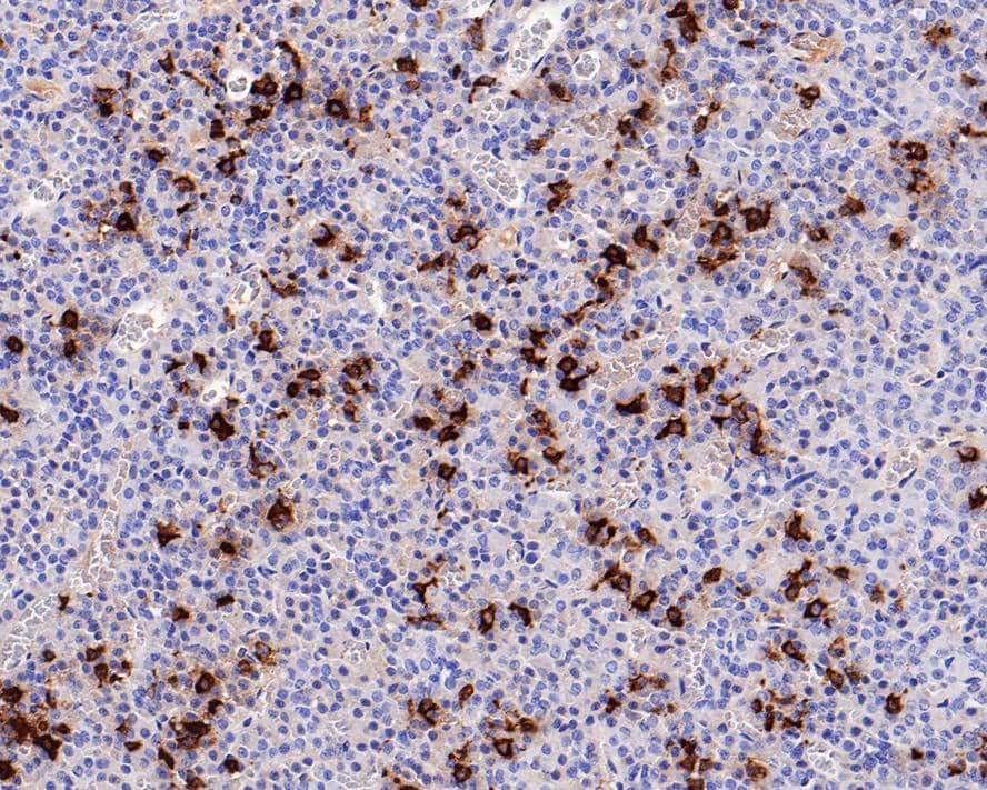 Immunohistochemistry: POMC Antibody (PD01-40) [NBP3-32841] - Immunohistochemical analysis of paraffin-embedded rat pituitary tissue with Mouse anti-POMC antibody (NBP3-32841) at 1/4,000 dilution. The section was pre-treated using heat mediated antigen retrieval with Tris-EDTA buffer (pH 9.0) for 20 minutes. The tissues were blocked in 1% BSA for 20 minutes at room temperature, washed with ddH2O and PBS, and then probed with the primary antibody (NBP3-32841) at 1/4,000 dilution for 1 hour at room temperature. The detection was performed using an HRP conjugated compact polymer system. DAB was used as the chromogen. Tissues were counterstained with hematoxylin and mounted with DPX.