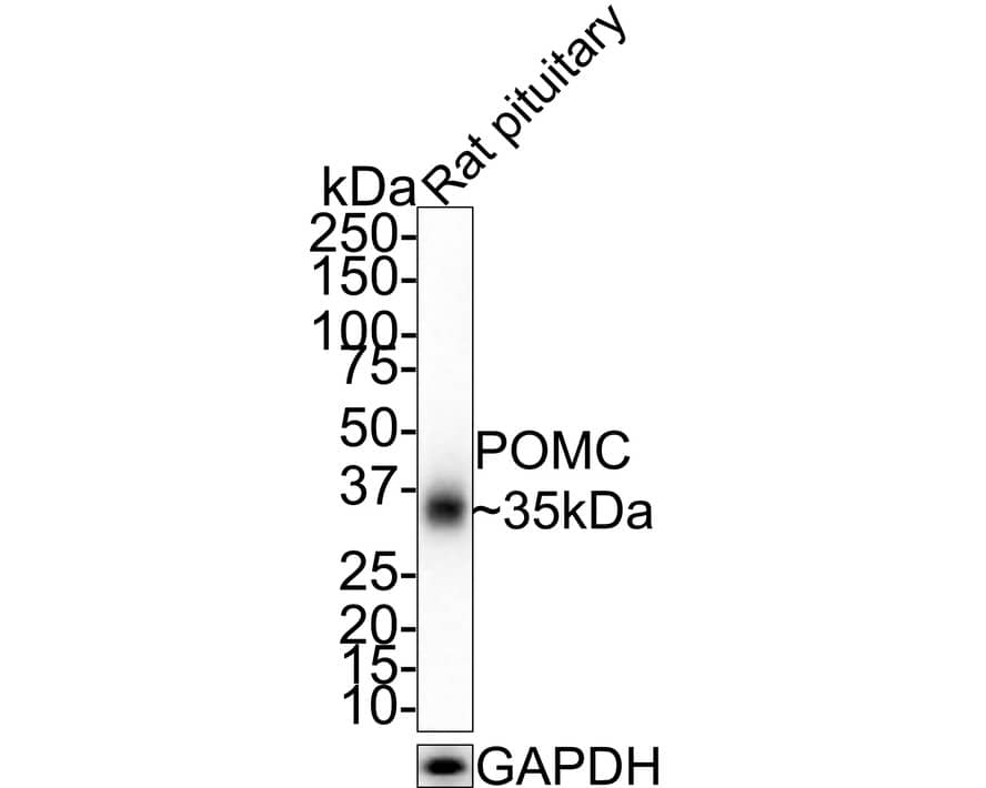 Western Blot: POMC Antibody (JE32-88) [NBP3-32842] - Western blot analysis of POMC on rat pituitary tissue lysates with Rabbit anti-POMC antibody (NBP3-32842) at 1/1,000 dilution. Lysates/proteins at 10 ug/Lane. Predicted band size: 29 kDa Observed band size: 35 kDa Exposure time: 1 minute; 4-20% SDS-PAGE gel. Proteins were transferred to a PVDF membrane and blocked with 5% NFDM/TBST for 1 hour at room temperature. The primary antibody (NBP3-32842) at 1/1,000 dilution was used in 5% NFDM/TBST at room temperature for 2 hours. Goat Anti-Rabbit IgG - HRP Secondary Antibody at 1:200,000 dilution was used for 1 hour at room temperature.