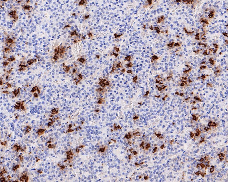 Immunohistochemistry: POMC Antibody (JE32-88) [NBP3-32842] - Immunohistochemical analysis of paraffin-embedded rat pituitary tissue with Rabbit anti-POMC antibody (NBP3-32842) at 1/1,000 dilution. The section was pre-treated using heat mediated antigen retrieval with Tris-EDTA buffer (pH 9.0) for 20 minutes. The tissues were blocked in 1% BSA for 20 minutes at room temperature, washed with ddH2O and PBS, and then probed with the primary antibody (NBP3-32842) at 1/1,000 dilution for 1 hour at room temperature. The detection was performed using an HRP conjugated compact polymer system. DAB was used as the chromogen. Tissues were counterstained with hematoxylin and mounted with DPX.