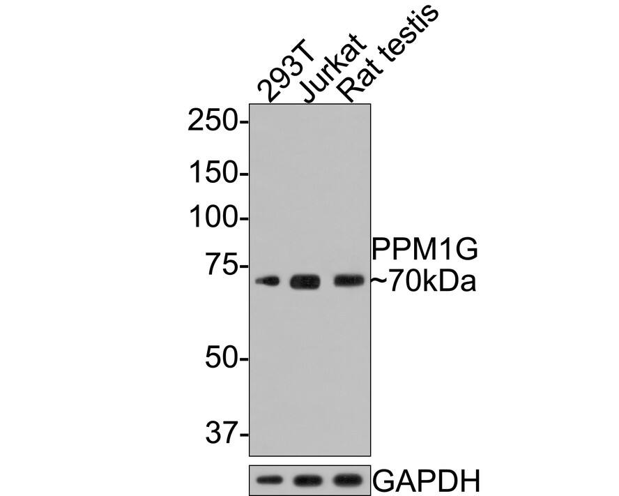 Western Blot: PP2C gamma/PPM1G Antibody (JE64-91) [NBP3-32844] - Western blot analysis of PP2C gamma/PPM1G on different lysates with Rabbit anti-PP2C gamma/PPM1G antibody (NBP3-32844) at 1/500 dilution. Lane 1: 293T cell lysate, 10 ug/Lane Lane 2: Jurkat cell lysate, 10 ug/Lane Lane 3: Rat testis tissue lysate, 20 ug/Lane Predicted band size: 59 kDa Observed band size: 70 kDa Exposure time: 2 minutes; 8% SDS-PAGE gel. Proteins were transferred to a PVDF membrane and blocked with 5% NFDM/TBST for 1 hour at room temperature. The primary antibody (NBP3-32844) at 1/500 dilution was used in 5% NFDM/TBST at room temperature for 2 hours. Goat Anti-Rabbit IgG - HRP Secondary Antibody at 1:300,000 dilution was used for 1 hour at room temperature.