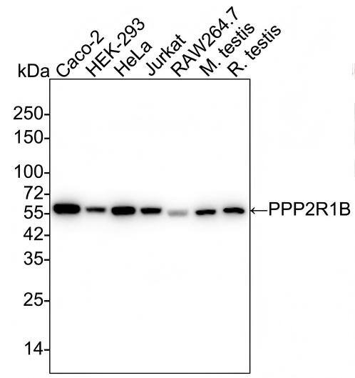 Western blot analysis on different lysates with NBP3-32845 at 1/2,000 dilution and competitor's antibody at 1/2,000 dilution. Lane 1: Caco-2 cell lysate Lane 2: HEK-293 cell lysate Lane 3: HeLa cell lysate Lane 4: Jurkat cell lysate Lane 5: RAW264.7 cell lysate Lane 6: Mouse testis tissue lysate Lane 7: Rat testis tissue lysate Lysates/proteins at 20 µg/Lane. Predicted band size: 66 kDa Observed band size: 66 kDa Exposure time: 30 seconds;  4-20% SDS-PAGE gel. Proteins were transferred to a PVDF membrane and blocked with 5% NFDM/TBST for 1 hour at room temperature. NBP3-32845 at 1/2,000 dilution and competitor's antibody at 1/2,000 dilution were used in 5% NFDM/TBST at 4℃ overnight. Goat Anti-Rabbit IgG [HRP] Secondary Antibody at 1/50,000 dilution was used for 1 hour at room temperature.