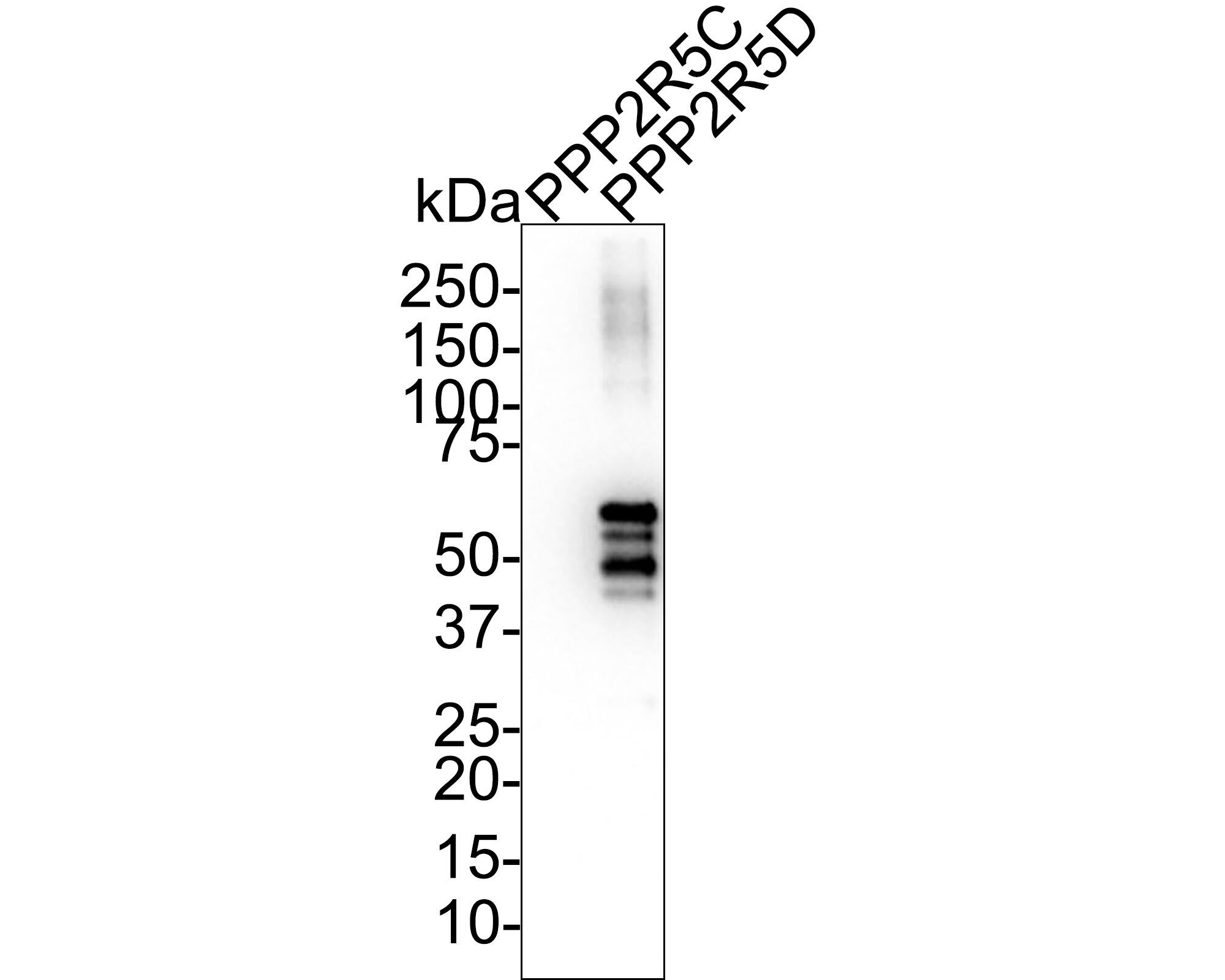 Western blot analysis on different lysates with NBP3-32846 at 1/1,000 dilution. Lane 1: Human PPP2R5C recombinant protein aa (aa1-524) 50ng Lane 2: Human PPP2R5D recombinant protein aa (aa107-602) 50ng Exposure time: 40 seconds; 4-20% SDS-PAGE gel. Proteins were transferred to a PVDF membrane and blocked with 5% NFDM/TBST for 1 hour at room temperature. NBP3-32846 at 1/1,000 dilution was used in 5% NFDM/TBST at room temperature for 2 hours. Goat Anti-Rabbit IgG [HRP] Secondary Antibody at 1:100,000 dilution was used for 1 hour at room temperature.