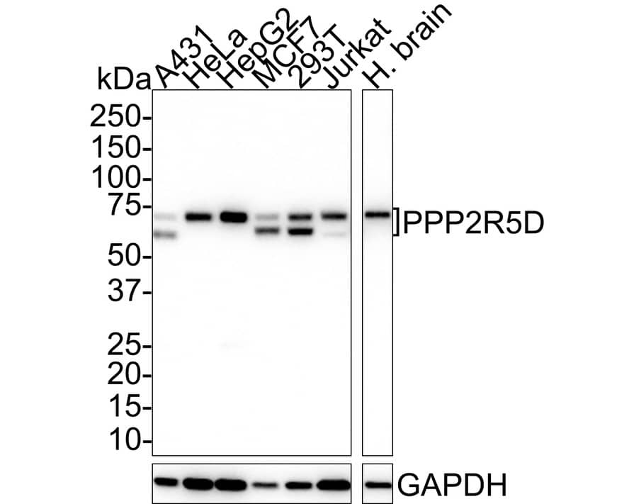 Western Blot: PPP2R5D Antibody (PSH01-21) [NBP3-32846] - Western blot analysis of PPP2R5D on different lysates with Rabbit anti-PPP2R5D antibody (NBP3-32846) at 1/1,000 dilution. Lane 1: A431 cell lysate (20 ug/Lane) Lane 2: HeLa cell lysate (20 ug/Lane) Lane 3: HepG2 cell lysate (20 ug/Lane) Lane 4: MCF7 cell lysate (20 ug/Lane) Lane 5: 293T cell lysate (20 ug/Lane) Lane 6: Jurkat cell lysate (20 ug/Lane) Lane 7: Human brain tissue lysate (40 ug/Lane) Predicted band size: 70 kDa Observed band size: 56~70 kDa Exposure time: 2 minutes 10 seconds; 4-20% SDS-PAGE gel. Proteins were transferred to a PVDF membrane and blocked with 5% NFDM/TBST for 1 hour at room temperature. The primary antibody (NBP3-32846) at 1/1,000 dilution was used in 5% NFDM/TBST at room temperature for 2 hours. Goat Anti-Rabbit IgG - HRP Secondary Antibody at 1:100,000 dilution was used for 1 hour at room temperature.