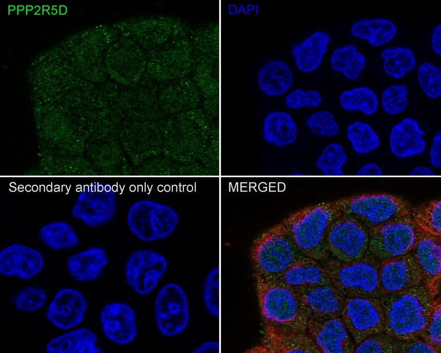 Immunocytochemistry/ Immunofluorescence: PPP2R5D Antibody (PSH01-21) [NBP3-32846] - Immunocytochemistry analysis of A431 cells labeling PPP2R5D with Rabbit anti-PPP2R5D antibody (NBP3-32846) at 1/100 dilution. Cells were fixed in 4% paraformaldehyde for 20 minutes at room temperature, permeabilized with 0.1% Triton X-100 in PBS for 5 minutes at room temperature, then blocked with 1% BSA in 10% negative goat serum for 1 hour at room temperature. Cells were then incubated with Rabbit anti-PPP2R5D antibody (NBP3-32846) at 1/100 dilution in 1% BSA in PBST overnight at 4 ℃. Goat Anti-Rabbit IgG H&L (iFluor™ 488) was used as the secondary antibody at 1/1,000 dilution. PBS instead of the primary antibody was used as the secondary antibody only control. Nuclear DNA was labelled in blue with DAPI. Beta tubulin (red) was stained at 1/100 dilution overnight at +4℃. Goat Anti-Mouse IgG H&L (iFluor™ 594) was used as the secondary antibody at 1/1,000 dilution.