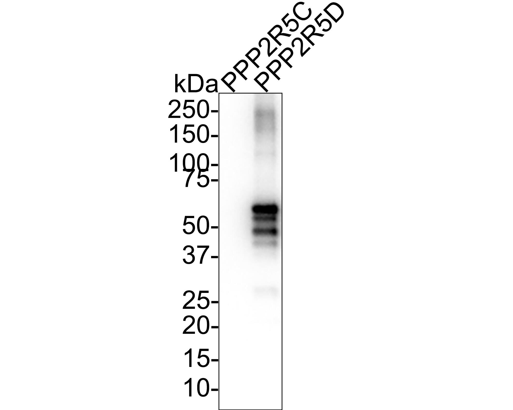 Western blot analysis on different lysates with NBP3-32847 at 1/1,000 dilution. Lane 1: Human PPP2R5C recombinant protein aa (aa1-524) 50ng Lane 2: Human PPP2R5D recombinant protein aa (aa107-602) 50ng Exposure time: 14 seconds; 4-20% SDS-PAGE gel. Proteins were transferred to a PVDF membrane and blocked with 5% NFDM/TBST for 1 hour at room temperature. NBP3-32847 at 1/1,000 dilution was used in 5% NFDM/TBST at room temperature for 2 hours. Goat Anti-Rabbit IgG [HRP] Secondary Antibody at 1:100,000 dilution was used for 1 hour at room temperature.