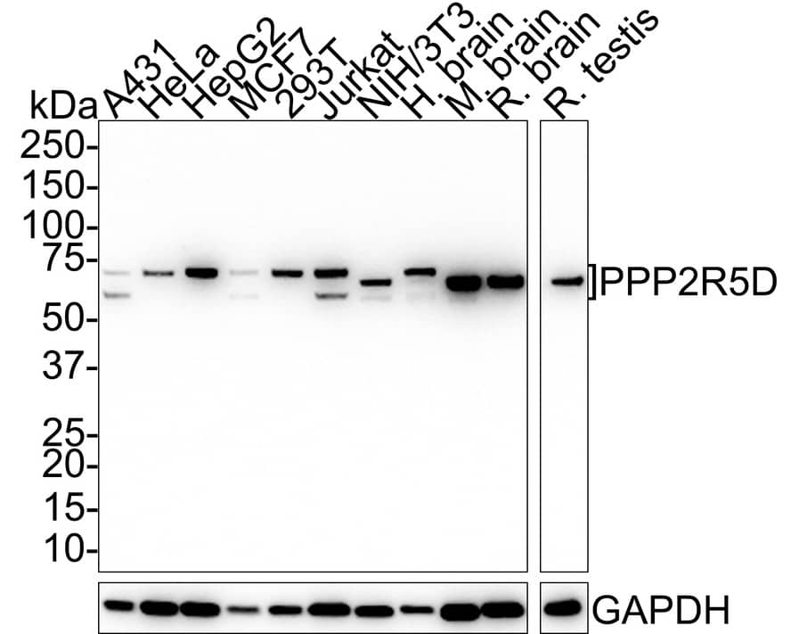 Western Blot: PPP2R5D Antibody (PSH01-22) [NBP3-32847] - Western blot analysis of PPP2R5D on different lysates with Rabbit anti-PPP2R5D antibody (NBP3-32847) at 1/1,000 dilution. Lane 1: A431 cell lysate (20 ug/Lane) Lane 2: HeLa cell lysate (20 ug/Lane) Lane 3: HepG2 cell lysate (20 ug/Lane) Lane 4: MCF7 cell lysate (20 ug/Lane) Lane 5: 293T cell lysate (20 ug/Lane) Lane 6: Jurkat cell lysate (20 ug/Lane) Lane 7: NIH/3T3 cell lysate (20 ug/Lane) Lane 8: Human brain tissue lysate (40 ug/Lane) Lane 9: Mouse brain tissue lysate (40 ug/Lane) Lane 10: Rat brain tissue lysate (40 ug/Lane) Lane 11: Rat testis tissue lysate (40 ug/Lane) Predicted band size: 70 kDa Observed band size: 56~70 kDa Exposure time: 2 minutes 10 seconds; 4-20% SDS-PAGE gel. Proteins were transferred to a PVDF membrane and blocked with 5% NFDM/TBST for 1 hour at room temperature. The primary antibody (NBP3-32847) at 1/1,000 dilution was used in 5% NFDM/TBST at room temperature for 2 hours. Goat Anti-Rabbit IgG - HRP Secondary Antibody at 1:100,000 dilution was used for 1 hour at room temperature.