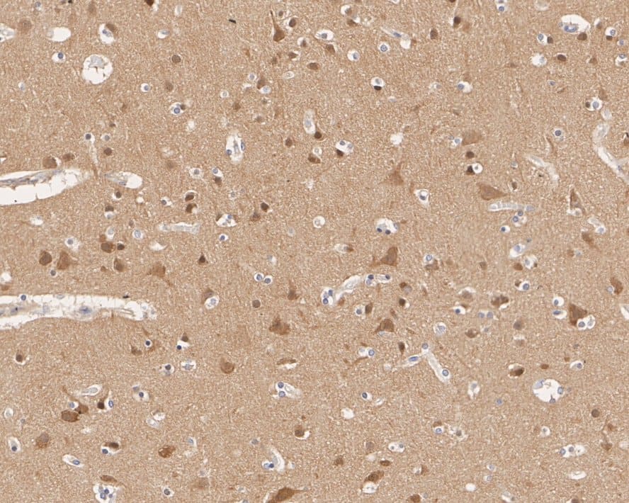 Immunohistochemistry: PPP2R5D Antibody (PSH01-22) [NBP3-32847] - Immunohistochemical analysis of paraffin-embedded human brain tissue with Rabbit anti-PPP2R5D antibody (NBP3-32847) at 1/1,000 dilution. The section was pre-treated using heat mediated antigen retrieval with sodium citrate buffer (pH 6.0) for 2 minutes. The tissues were blocked in 1% BSA for 20 minutes at room temperature, washed with ddH2O and PBS, and then probed with the primary antibody (NBP3-32847) at 1/1,000 dilution for 1 hour at room temperature. The detection was performed using an HRP conjugated compact polymer system. DAB was used as the chromogen. Tissues were counterstained with hematoxylin and mounted with DPX.