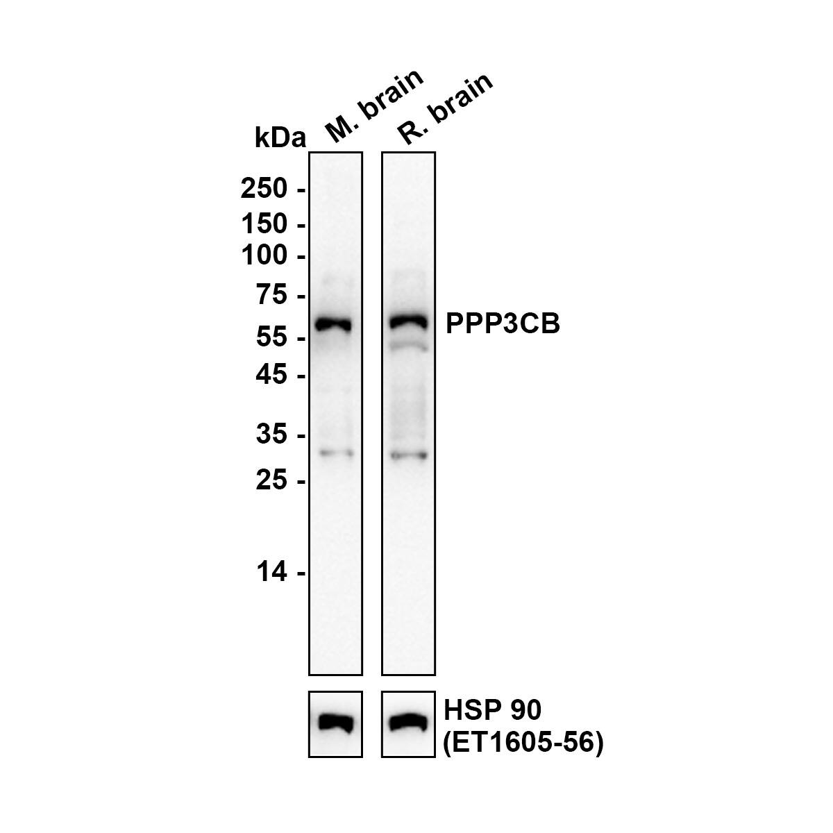 Western blot analysis on different lysates with NBP3-32848 at 1/5,000 dilution. Lane 1: Mouse brain tissue lysate Lane 2: Rat brain tissue lysate Lysates/proteins at 20 µg/Lane. Exposure time: 30 seconds Blocking: 5% NFDM/TBST, 1 hour at room temperature Primary antibody: NBP3-32848, 1/5,000 in primary antibody dilution buffer, overnight at 4 ℃ Secondary antibody: Goat Anti-Rabbit IgG [HRP] Secondary Antibody, 1/50,000 in 5% NFDM/TBST, 1 hour at room temperature Predicted band size: 59 kDa Observed band size: 59 kDa