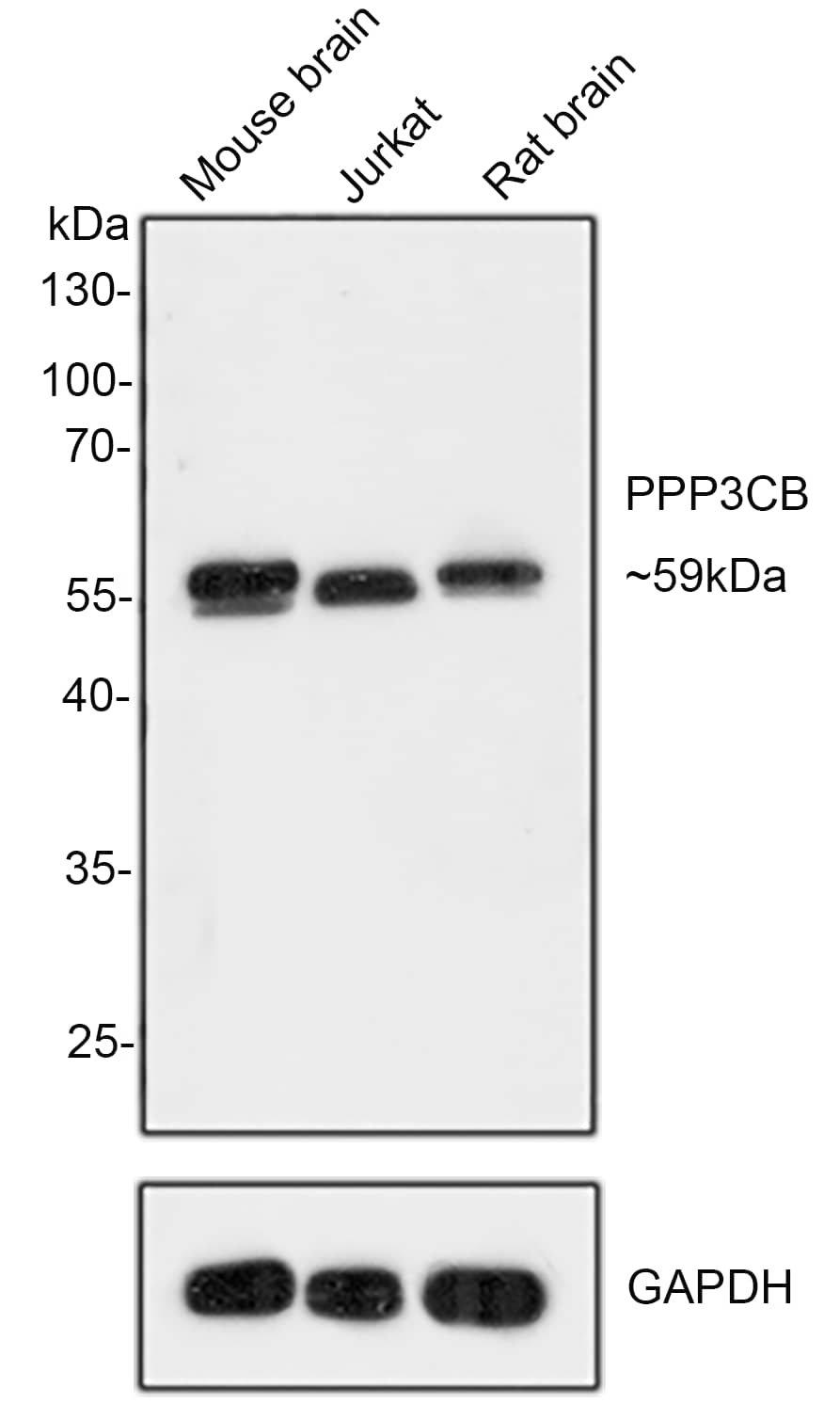 Western Blot: PPP3CB Antibody (PSH0-21) [NBP3-32848] - Western blot analysis of PPP3CB on different lysates with Rabbit anti-PPP3CB antibody (NBP3-32848) at 1/1,000 dilution. Lane 1: Mouse brain tissue lysate Lane 2: Jurkat cell lysate  Lane 3: Rat brain tissue lysate Lysates/proteins at 10 ug/Lane. Predicted band size: 59 kDa Observed band size: 59 kDa Exposure time: 2 minutes; 10% SDS-PAGE gel. Proteins were transferred to a PVDF membrane and blocked with 5% NFDM for 1 hour at room temperature. The primary antibody (NBP3-32848) at 1/1,000 dilution was used in 5% NFDM at room temperature for 2 hours. Goat Anti-Rabbit IgG - HRP Secondary Antibody at 1:300,000 dilution was used for 1 hour at room temperature.