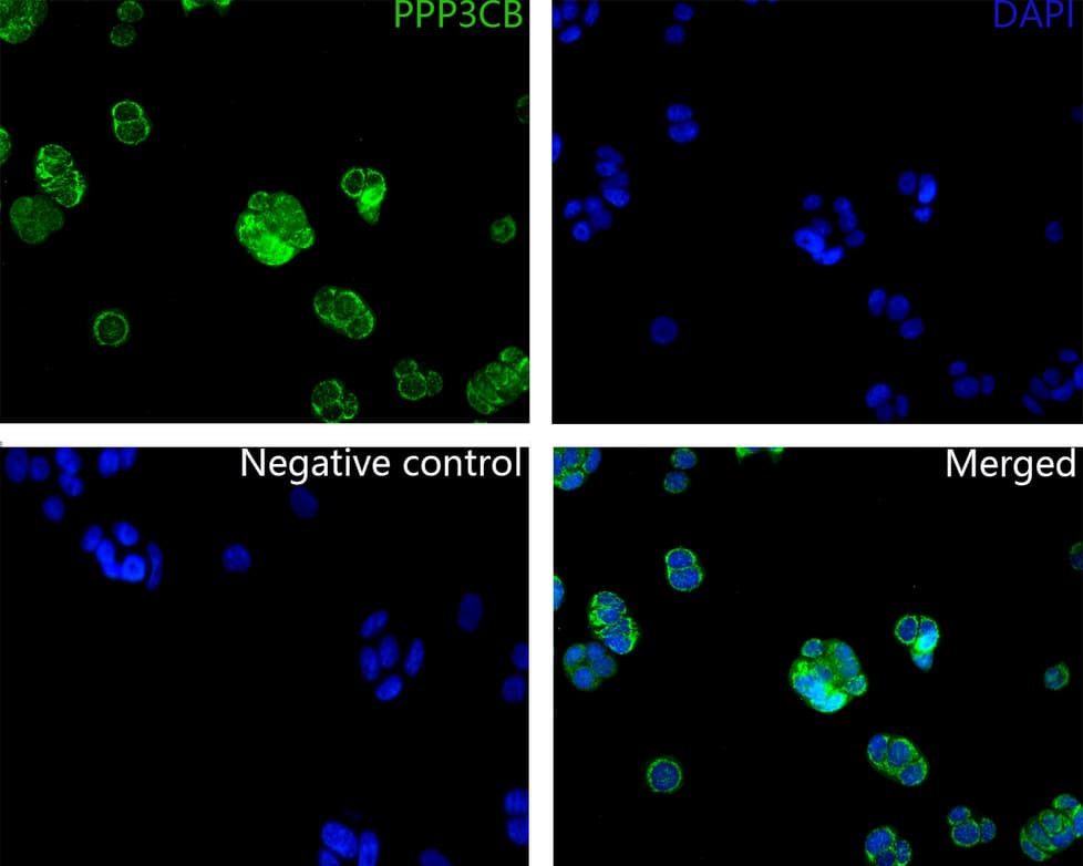 Immunocytochemistry/ Immunofluorescence: PPP3CB Antibody (PSH0-21) [NBP3-32848] - Immunocytochemistry analysis of MCF-7 cells labeling PPP3CB with Rabbit anti-PPP3CB antibody (NBP3-32848) at 1/200 dilution. Cells were fixed in 4% paraformaldehyde for 10 minutes at 37 ℃, permeabilized with 0.05% Triton X-100 in PBS for 20 minutes, and then blocked with 2% negative goat serum for 30 minutes at room temperature. Cells were then incubated with Rabbit anti-PPP3CB antibody (NBP3-32848) at 1/200 dilution in 2% negative goat serum overnight at 4 ℃. Goat Anti-Rabbit IgG H&L (iFluor™ 488) was used as the secondary antibody at 1/1,000 dilution. PBS instead of the primary antibody was used as the secondary antibody only control. Nuclear DNA was labelled in blue with DAPI.