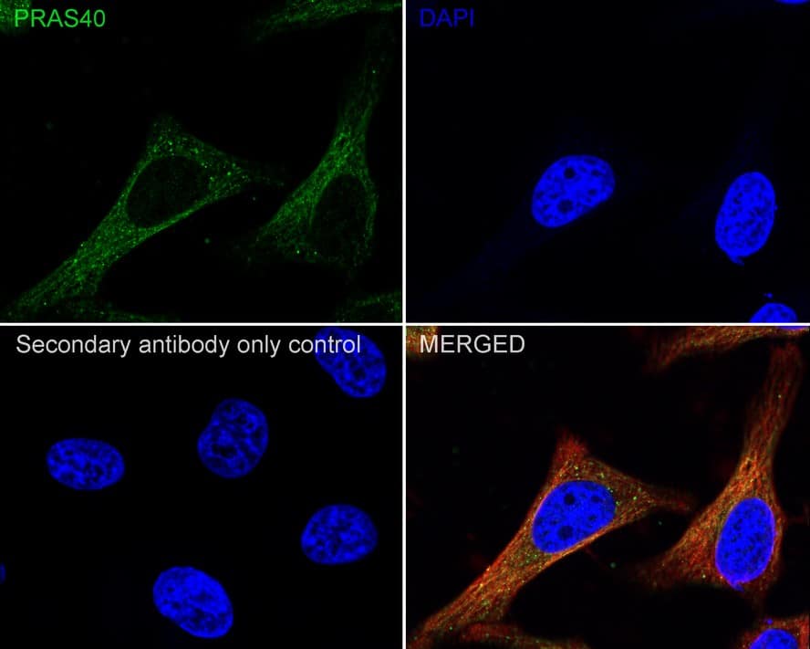 Immunocytochemistry/ Immunofluorescence: PRAS40 Antibody (JE30-60) [NBP3-32850] - Immunocytochemistry analysis of HeLa cells labeling PRAS40 with Rabbit anti-PRAS40 antibody (NBP3-32850) at 1/100 dilution. Cells were fixed in 4% paraformaldehyde for 20 minutes at room temperature, permeabilized with 0.1% Triton X-100 in PBS for 5 minutes at room temperature, then blocked with 1% BSA in 10% negative goat serum for 1 hour at room temperature. Cells were then incubated with Rabbit anti-PRAS40 antibody (NBP3-32850) at 1/100 dilution in 1% BSA in PBST overnight at 4 ℃. Goat Anti-Rabbit IgG H&L (iFluor™ 488) was used as the secondary antibody at 1/1,000 dilution. PBS instead of the primary antibody was used as the secondary antibody only control. Nuclear DNA was labelled in blue with DAPI. Beta tubulin (red) was stained at 1/100 dilution overnight at +4℃. Goat Anti-Mouse IgG H&L (iFluor™ 594) was used as the secondary antibody at 1/1,000 dilution.